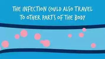 Free download Root Canal Patient Education video and edit with RedcoolMedia movie maker MovieStudio video editor online and AudioStudio audio editor onlin