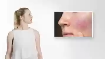 Free download Sanubiom SkinCare Protect - gegen Rosacea video and edit with RedcoolMedia movie maker MovieStudio video editor online and AudioStudio audio editor onlin