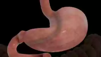 Free download Sleeve Gastrectomy Animation video and edit with RedcoolMedia movie maker MovieStudio video editor online and AudioStudio audio editor onlin