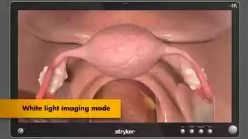 Free download Spy Agent Green Lymphatic Mapping Animation.mp4 video and edit with RedcoolMedia movie maker MovieStudio video editor online and AudioStudio audio editor onlin