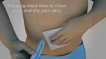 Free download StomaGenie_Capture_Cartridge_Animation_Video video and edit with RedcoolMedia movie maker MovieStudio video editor online and AudioStudio audio editor onlin