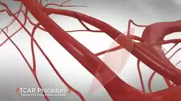 Free download TCAR_90sec_Animation_AP134-D video and edit with RedcoolMedia movie maker MovieStudio video editor online and AudioStudio audio editor onlin