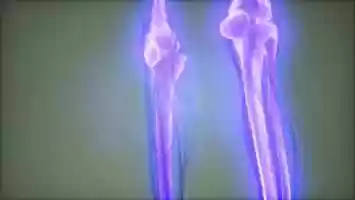 Free download Transparent Human Body with Visible Bones | Motion Graphics - Videohive template video and edit with RedcoolMedia movie maker MovieStudio video editor online and AudioStudio audio editor onlin