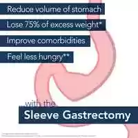Free download UB Gastric Sleeve animation video and edit with RedcoolMedia MovieStudio video editor online and AudioStudio audio editor onlin