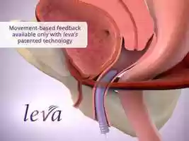 Free download Urinary Incontinence and leva in Action video and edit with RedcoolMedia movie maker MovieStudio video editor online and AudioStudio audio editor onlin