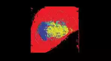 Free download YCN Brief - Action On Hearing Loss video and edit with RedcoolMedia movie maker MovieStudio video editor online and AudioStudio audio editor onlin