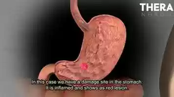 Free download Zinc Carnosine Science video and edit with RedcoolMedia movie maker MovieStudio video editor online and AudioStudio audio editor onlin